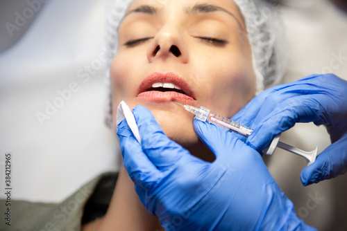 Cuadros en Lienzo Beautiful, attractive, young woman, lying relaxed in dermatologist ordination, getting a rejuvenating lips treatment with hyaluronic acid filler