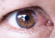 The eyes of people with cataract, a disease of the eye.