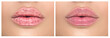 © Subbotina Anna - Lips. Close up of chapped, cracked lips, dry skin problem with mouth disease before and after treatment. Healthy woman lips, macro shot