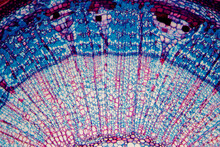 Micrograph Plant Cells Of Woody Dicot Stem