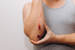 © Svyatoslav Balan - Large abrasions on the forearm of a man after a fall. The man holds his elbow with his hand.