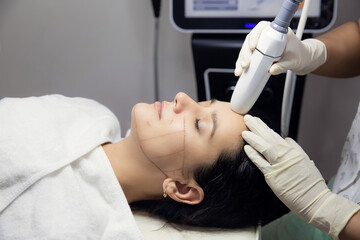 Woman receiving HUFU therapy- high intensity focused ultrasound treatment on face. Therapist doing non-surgical cosmetic plasma lift on female client forehead with ultrasonic device. SMAS lifting