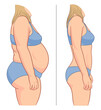Woman's body before and after weight loss. Vector illustration.