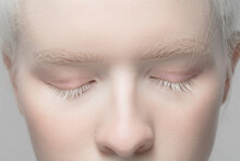 Nose And Eyelid. Close Up Portrait Of Beautiful Albino Female Model. Parts Of Face And Body. Beauty, Fashion, Skincare, Cosmetics, Wellness Concept. Copyspace. Well-kept Skin, Fresh Look, Details.