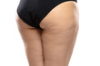 © master1305 - Back view. Overweight woman with fat cellulite legs and buttocks, obesity female body in black underwear isolated on white background. Orange peel skin, liposuction, healthcare and beauty treatment.
