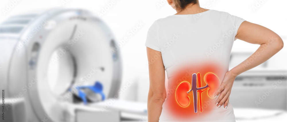 Medicine poster for CT scan kidney. Woman with kidney pain standing near a tomography machine - obrazy, fototapety, plakaty 