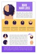 Man hairloss problem flat illustration Baldness stages