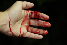 Close Up Hand Injury, Finger Cut With Knife, Real Bloody Hand