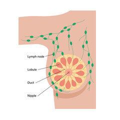 Poster - Breast disease concept