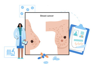 Poster - Breast disease concept