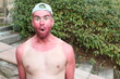 Man with pale complexion getting sunburnt 
