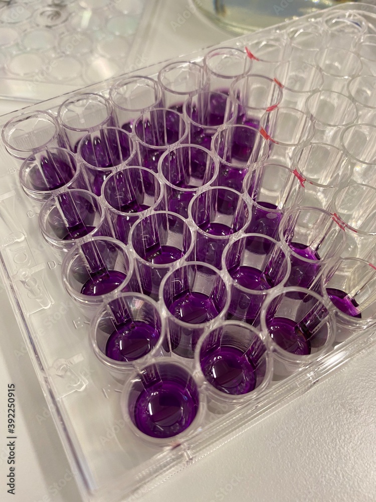 MTT assay protocol for measuring cell viability, proliferation and ...