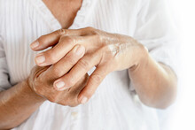 Close-up Of Senior Woman With Wrinkled Fractured Hands