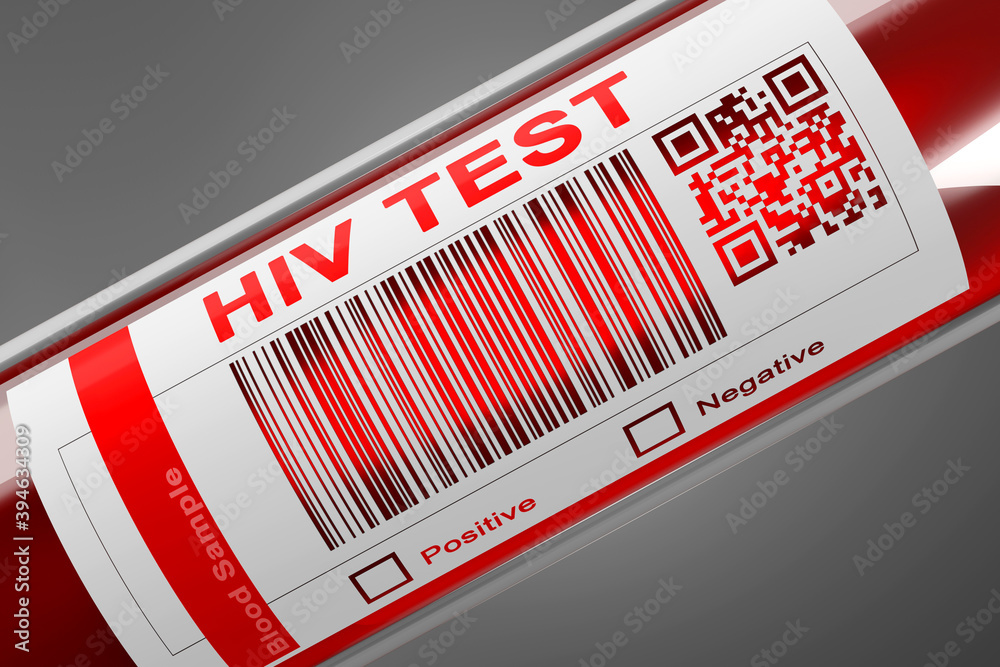HIV Blood check Test tube 3D Illustration Stock Illustration | Adobe Stock