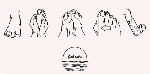 Hallux valgus therapy,  foot massage, and prevention. Feet problems: deformity, bone fracture, edema, and skin irritation. Orthopedic vector icons collection in outlines 