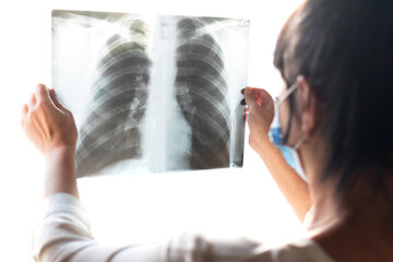 Wall Mural - X-ray image of the lungs infected with the coronavirus. The doctor looks at the result of the X-ray examination. Diagnosis of viral pneumonia. Selective focus