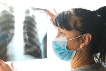 Wall Mural - Portrait of a doctor looking at the result of x-ray examination. Diagnosis of viral pneumonia. Selective focus