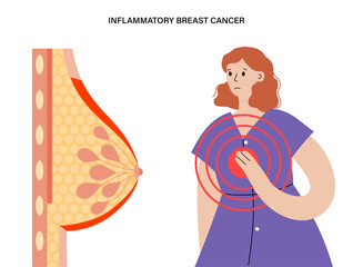 Sticker - Breast disease concept