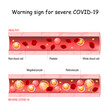 COVID-19. Warning sign for severe acute respiratory syndrome coronavirus disease