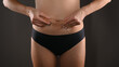 © Tatsiana - Woman showing stretch mark, loose lower, abdomen skin. She fat after pregnancy baby birth.