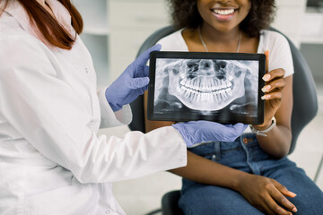 Wall Mural - Close up cropped image of female dentist and african american woman patient at dentist's office, holding together digital tablet with patient xray panoramic jaw and teeth image. Oral care and check up