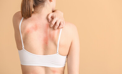 Wall Mural - Young allergic woman scratching her skin against color background