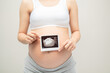 Pregnant girl shows an ultrasound photo of her undorn baby. Portrait of a child on an ultrasound photo