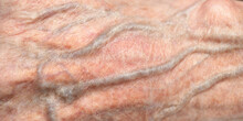 Close Up Of Vein Under Skin Of Senior 90 Year Old Man's Wrinkled Skin, White Asian Women.
