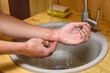 A man washes an abrasion on his arm under running water