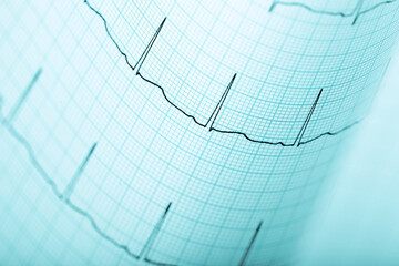 Medical background with ECG line on blue graph paper