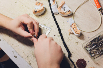 The process of making a dental prosthesis in a dental laboratory.