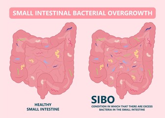 intestine bacteria gut pain eating IBS large fungal fungi tract H. pylori c. diff cancer gas colon Rectal vomiting spastic mucous colitis viral acid level celiac  Crohn's abdomen yeast system germs