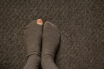 Wall Mural - woman's toe came out of a torn sock on the floor of the house close-up, female feet on the floor