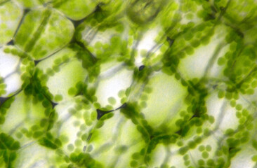 fuzzy plant cells seen under a microscope