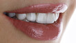 © Dental Pro Content - perfect smile of a girl with veneers and beautiful lipstick