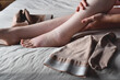 Woman putting on compression stockings on swollen feet affected by lymphedema condition