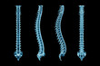 © Matthieu - X-Ray human spinal column or backbone or spine from various angles isolated on black background 3D render illustration. Medical and anatomy imagery.
