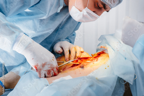 Fototapeta na szkło In a modern veterinary clinic, an operation is performed to save the life of a large dog. Surgery and medicine