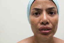 Woman With Very Oily Facial Skin