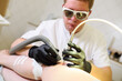 © Evgeniy Kalinovskiy - A male vascular surgeon removes rosacea or vascular mesh on the patient's leg with a neodymium laser. Laser cosmetology