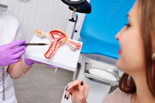 a young attractive girl at a women\'s consultation with a gynecologist. The gynecologist shows the patient a model of the uterus  against the background of a gynecological chair.
