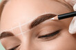 © Pixel-Shot - Young woman undergoing eyebrow correction procedure, closeup