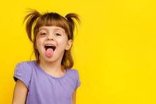 Close-up Of Laughing Funny Little Bad Girl With Bruised Eye Showing Her Tongue, Looking At Camera On Yellow Background. 