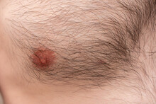 Closeup Of A Hairy Man's Chest, Male Nipple, Cropped Image