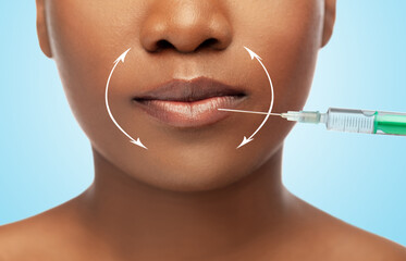 beauty, plastic surgery and people concept - close up of face of beautiful young african american woman and syringe with hyaluronal injection for lips augmentation over blue background