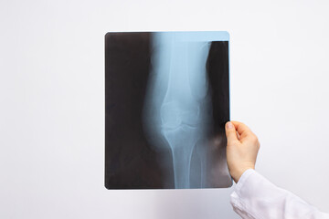 The doctor examines an X-ray of a patient with a knee injury on a white background with a place for text