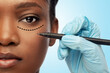 © Syda Productions - beauty, plastic surgery and people concept - close up of face of beautiful young african american woman with surgical mark under her eye and hand in glove with marker over blue background