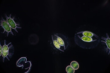 Wall Mural - Protozoa and Green Algae in waste water under the microscope.
