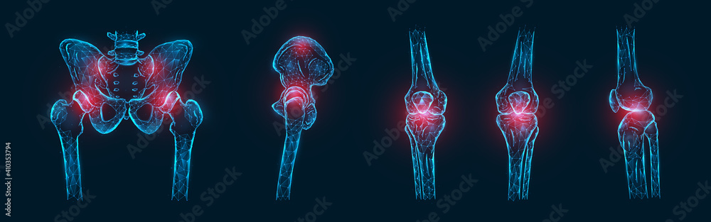 Polygonal vector illustration of pain or inflammation of the bones in the pelvis, hip joint, and knee joints isolated. Joint pain concept - obrazy, fototapety, plakaty 
