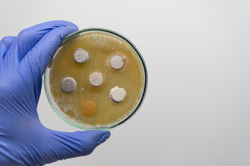 Sticker - Close-up, a scientist holds an open Petri dish with agar columns in his hand, on which bacteria have grown. An experiment on antagonism of microorganisms.